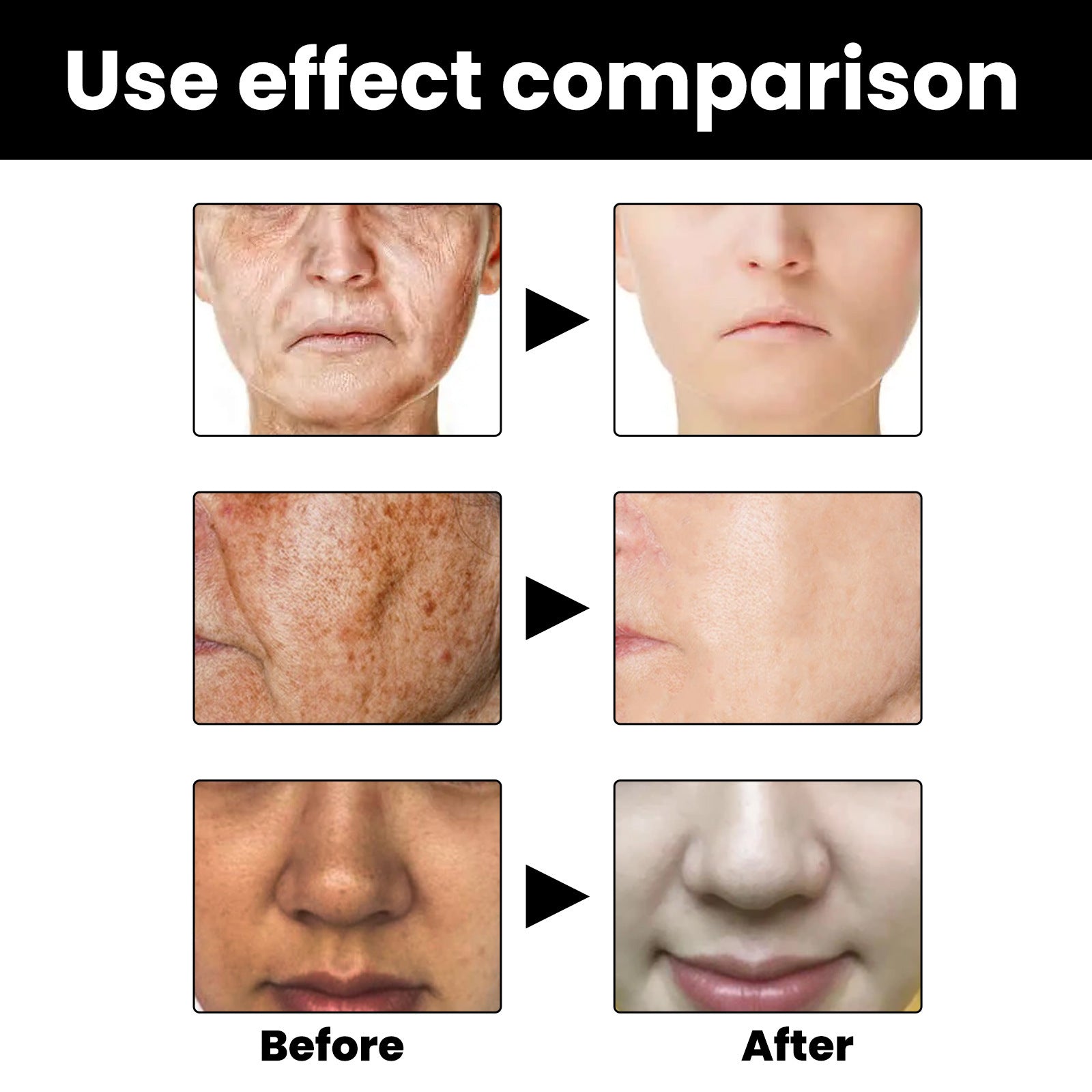 Facial Melanin Repair Hydrating Skincare Products - IceAndFire
