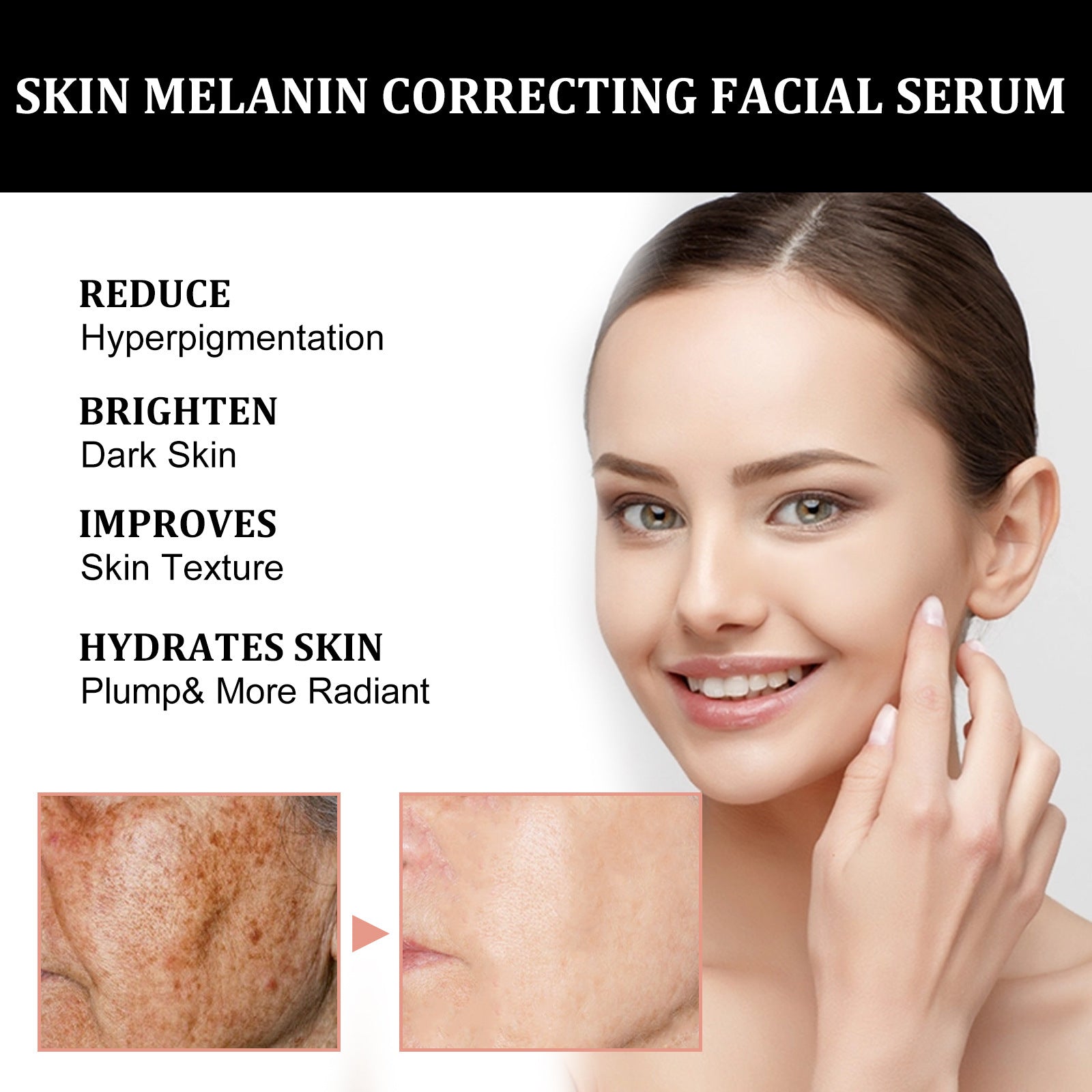 Facial Melanin Repair Hydrating Skincare Products - IceAndFire